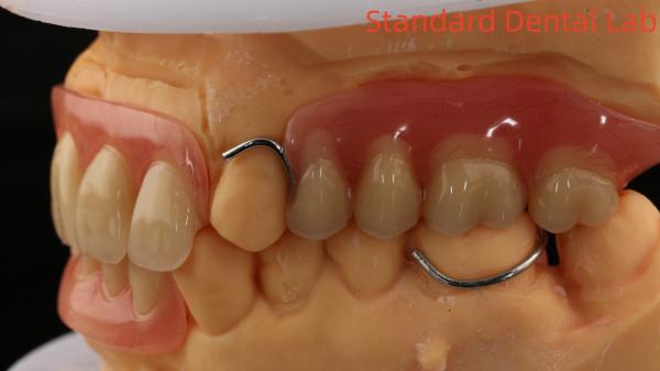 Dentures en acrylique complète ISO avec des dents d'or jaune