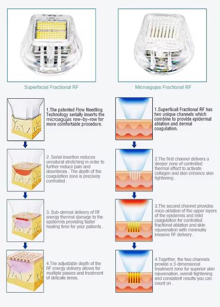 Cuidados com a pele Máquina de micro-agulha de vácuo para rejuvenescimento da pele