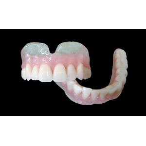 Removable Dentures