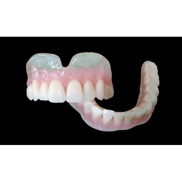 Vertex Clear Partial Overdenture Removable Partial Prosthodontics