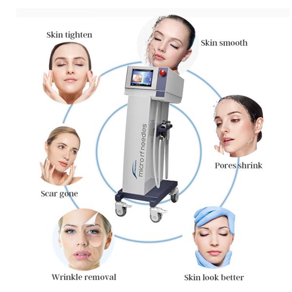 Прибор microneedle машины PDT 650nm RF Microneedling восходящего потока теплого воздуха ODM частичный