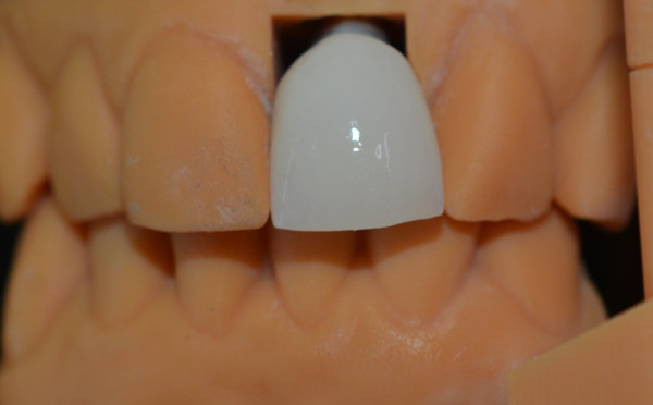 Enhance Your Lab s Efficiency with High-Durability Dental Prosthetic Lab