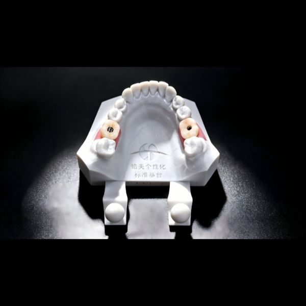 Non Precious PFM Crown Implant Porcelain Fused To Metal Crown