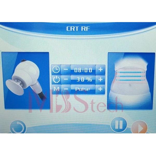 Машина терапией Tecar удаления Rf облегчения боли Indiba