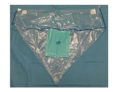 Medical TUR Fluid Collection Pouch Disposable For TUR Surgical Operations