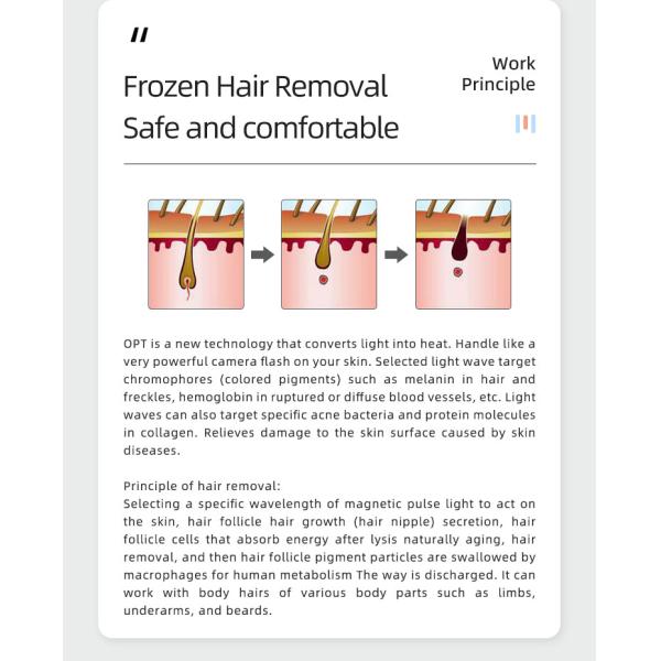 2 в 1 Q переключатель и yag ipl Удаление веснушек Лазер Yag Opt Shr Устройства для удаления волос