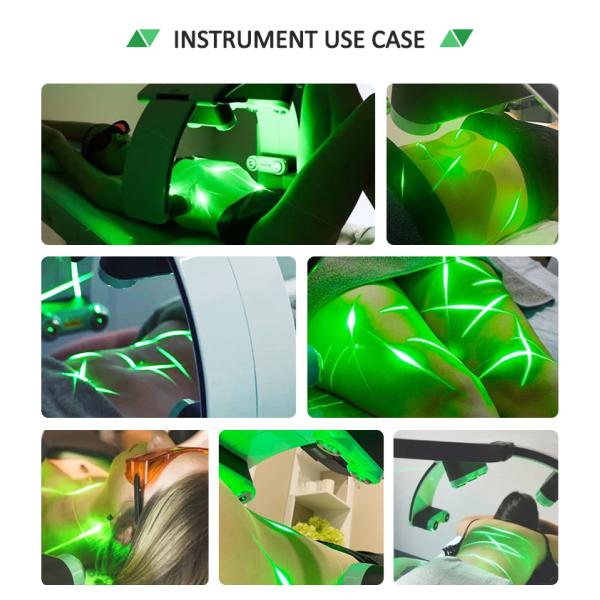 лечение раны боли удаления живота машины липосакции лазера 10D жирное