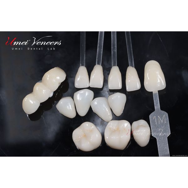 Natural White Cast Porcelain Veneers