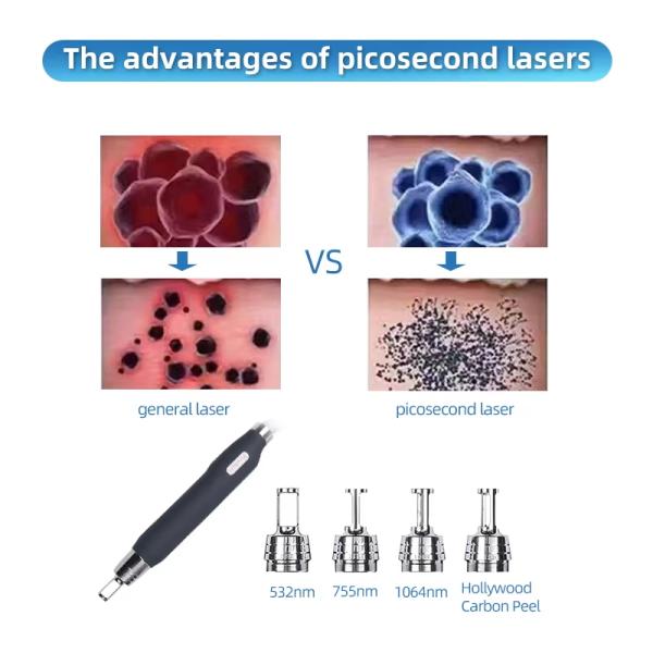 AS41 High Quality Honeycomb 1200w Power Nd Yag Solid State Laser Tattoo Removal Machine