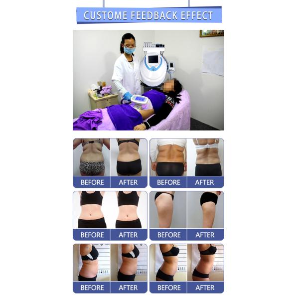 Cryo Cryolipolysis Slimming Cavitation Fat Loss Machine 4 In 1 Low Intensity