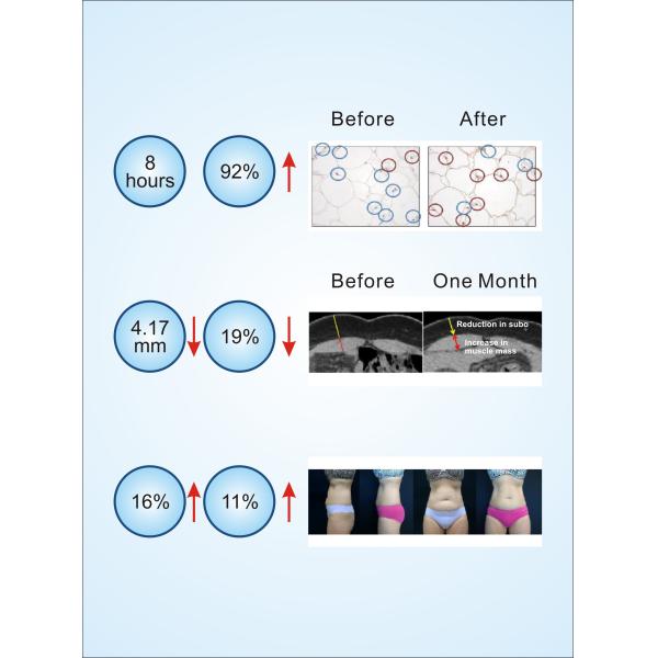 White 7 Tesla EMS Muscle Stimulator Machine Air Cooling For Weight Loss