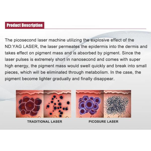 Hot Sale As60 Picosecond Nd Yag Laser Tattoo/Pigment/Eyebrow /Freckle Removal Beauty Salon Machine