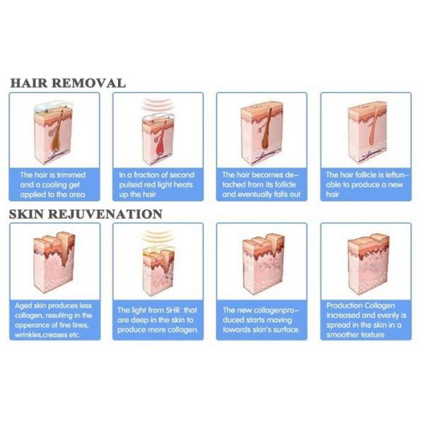OPT SHR Hair Removal Machine , Small Elight IPL RF Beauty Equipment