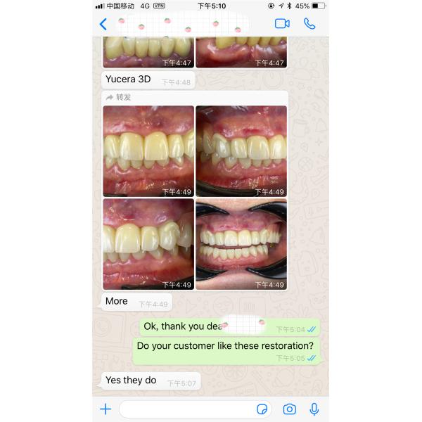 Разнослоистый зубоврачебный пробел Zirconia 1200HV для оборудований лаборатории Рональд