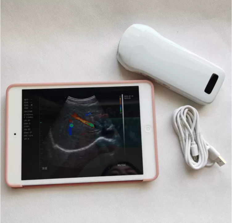 GYN Ultrasound Instruments Wireless Portable Clinical Probe Analytical Instruments Mobile Ultrasound Machine