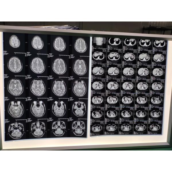 чернила принтера чернил струйного принтера 70ml L130 L805 L1300 L1800 Xp2100 Xp3100 Xp4100 Epson