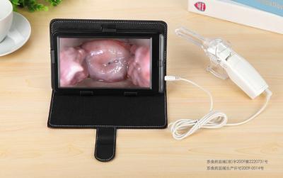 Ecrã de alta definição AV / USB saída sonda Vaginal Digital eletrônico colposcópio