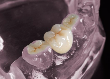 Colorful Pre Shaded 3D Pro Zirconia Block Multilayer Dental Laboratory Materials