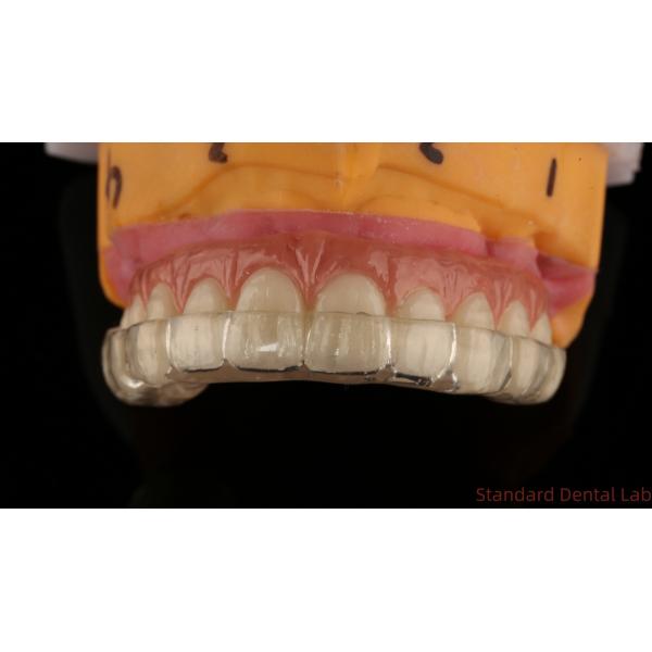 Professional Zirconia Dental Implant Crown Titanium CAD CAM Zirconia Crown China Dental Lab