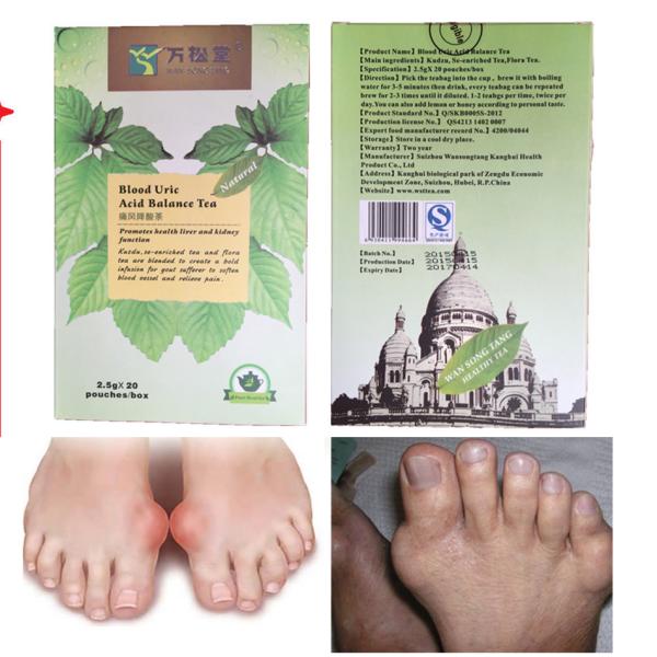 Herbal gout treatment Chinese gout relief tea teabag podagra big toe medication uric acid balance gout foot remedies