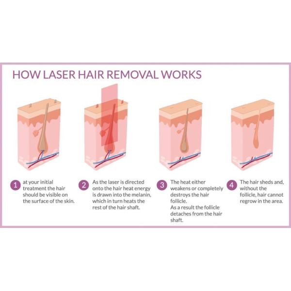 Оборудование красоты лазера диода 755 808 1064 подмолаживаний кожи удаления волос