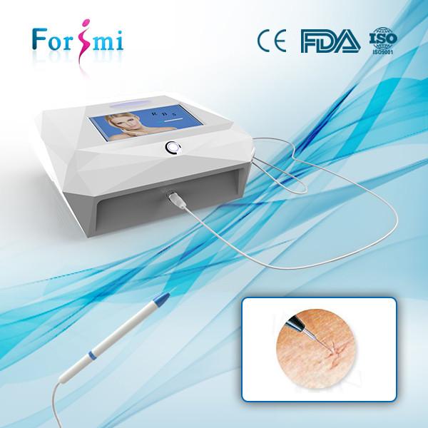 laser treatment for acne scars on whole body effective machine