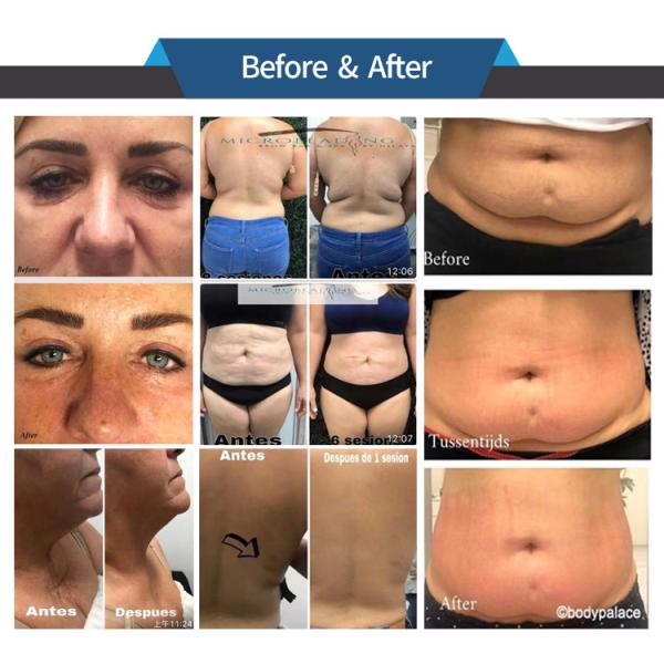 CE Sculpting Body Machine Vacuum Rf Led Ir Light Lymphatic Drainage For Salon