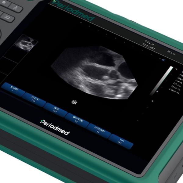 Yonker Factory Price Veterinary Ultrasound Machine Veterinary Ultrasound Portable Xuzhou Veterinary Ultrasound