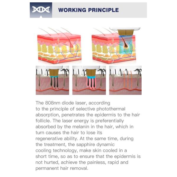 AS30 Hair Removal Laser machine 60 million times shot Perfect Cooling System device 808nm Diode Laser beauty equipment