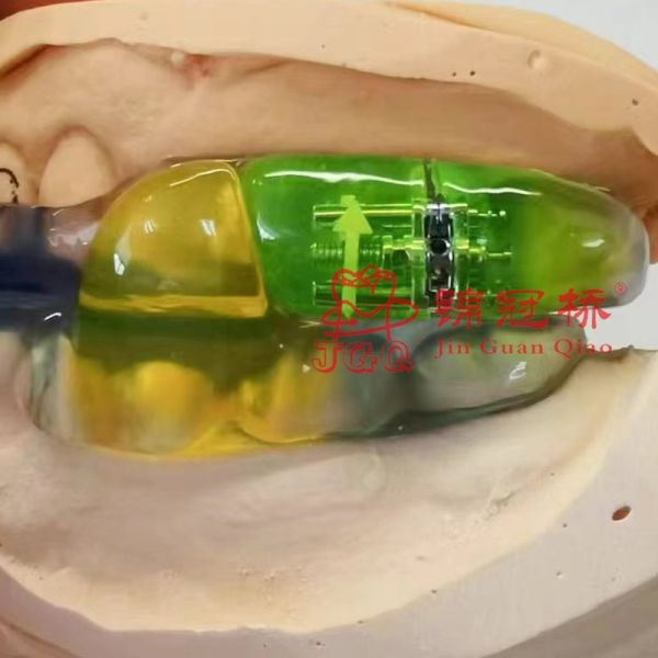 Dental Orthodontic Appliance Lab Denture Shark Anti Snoring Guard for Children Adults