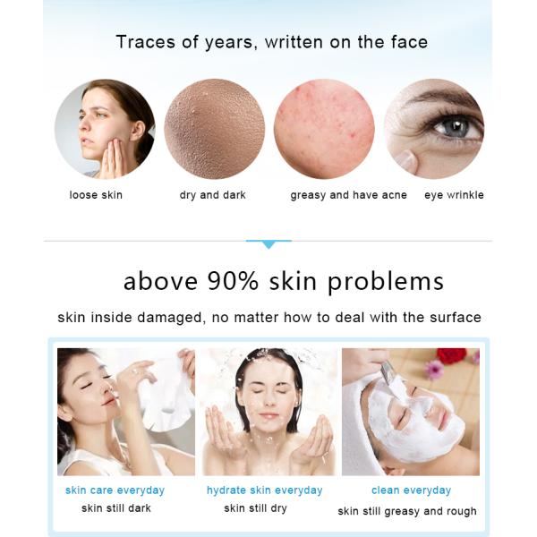 Oxygen Jet Peel Hydrafacial Machine For Skin Rejuvenation / Acne Treatment