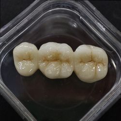 Customized Specification Denture Products Zirconia Ceramic Crowns and Bridge with Fast Turnaround Time CE FDA Certified