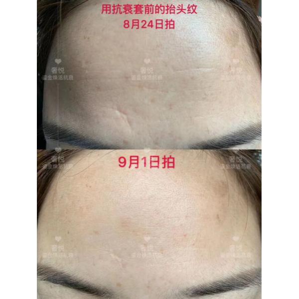 S-yue brand golden rejuvenating tightening series anti aging skin firming cosmetics