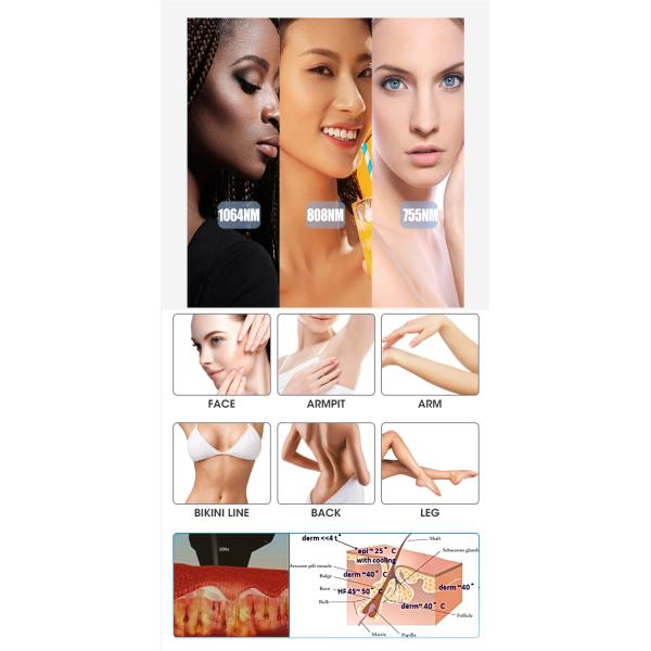 Máquina de depilación con láser de diodo Android 755 808 1064 Máquina de depilación permanente con láser de diodo