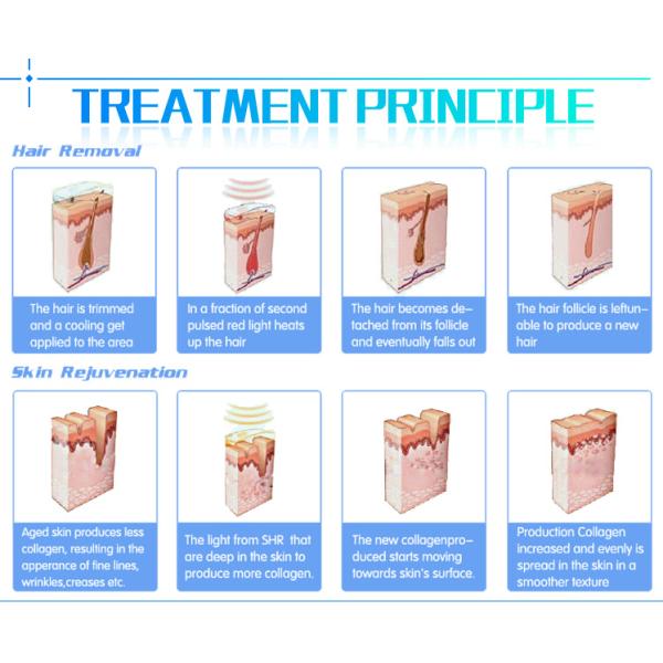 Beauty Salon Professional Laser Hair Removal Machine 60kg Weight CE Approved