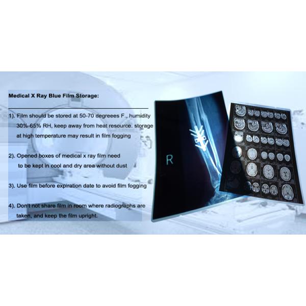 Цвет 215mic пластикового ясного фильма струйных принтеров медицинского x Рэй водоустойчивый голубой