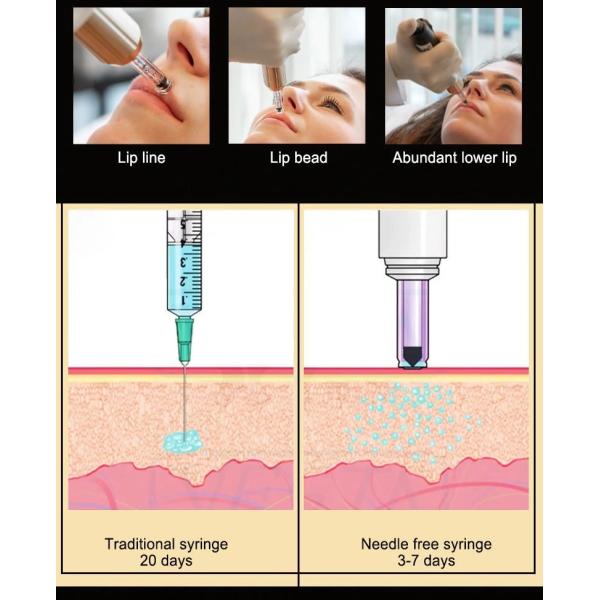 Ручка Hyaluron ручки заполнителя Hyaluron красоты 0.3ml 0.5ml для формировать стороны