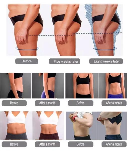 2 Handles or 4 Handles Muscle Building Body Sculpting Machine
