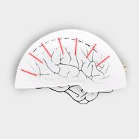 Medical Brain Rehabilition Infrared Transcrial Neuron Injury Physiotherapy Helmet For Depression Treat