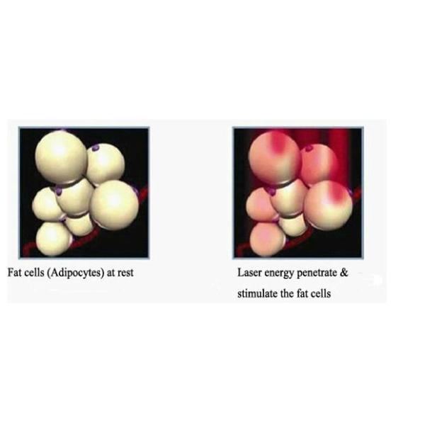 Vertical 1064 532 nm Q Switch ND YAG Laser Tattoo Removal Equipment