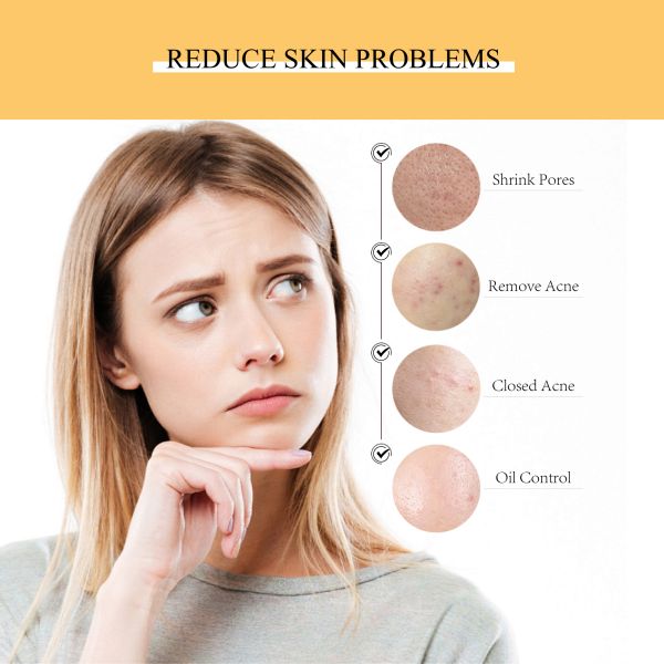 Factory Wholesale Organic Rice Facial Toner Nicotinamide Hydration Serum Moisturizer Day Night Skin Whitening Serum for Adults