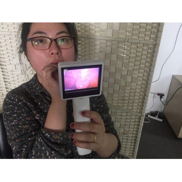 ЛКД контролирует объективы Отоскопе и прибора 3 Рхиноскопе портативные Хандхэльд диагностического опционные