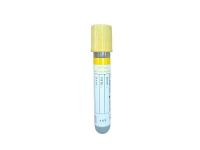 Tubo SST de vidro plástico para hospital Coleta de sangue de coágulo de gel de separação de soro médico