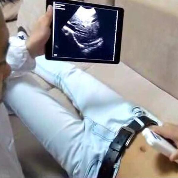 Mini Wireless Ultrasound Machine Probe Wifi Ultrasound Probe