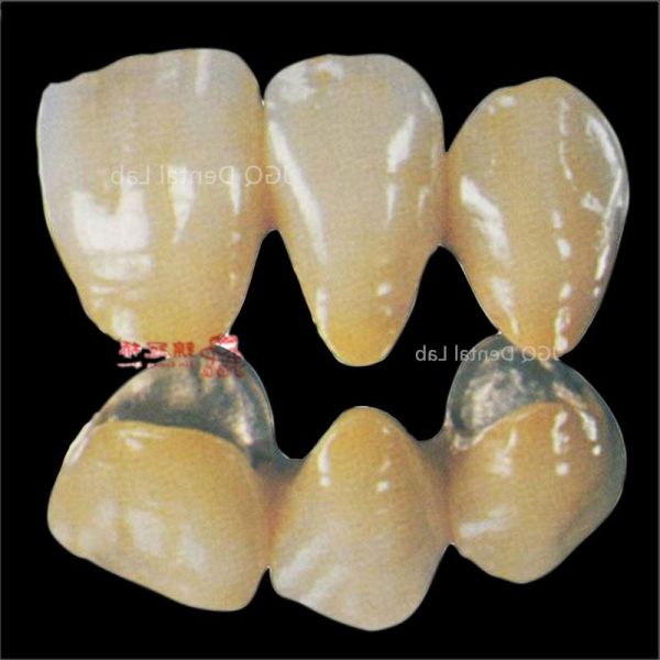 Porcelain Fused to Metal Crown and Bridge Made in China Dental Lab