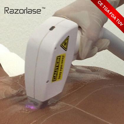 Полная машина удаления волос лазера тела, постоянная длина волны машины 808nm удаления волос