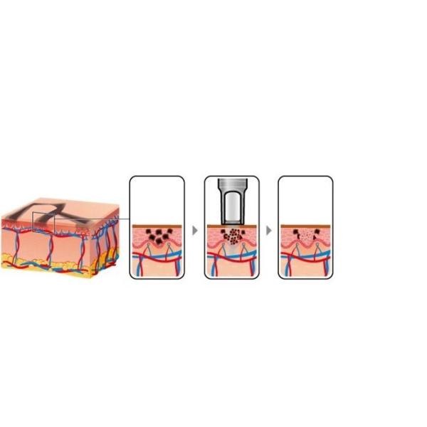 Multi функциональный 4 Odm OEM машины лазера диода Handpieces 808nm