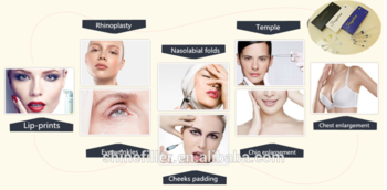 Croisez le remplisseur cutané lié d'acide hyaluronique pour les injections 20ml d'élargissement de sein