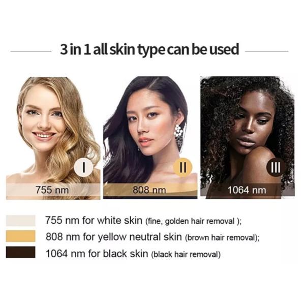 Máquina de diodo láser de 3 longitudes de onda para depilación profesional con frecuencia 1-10HZ