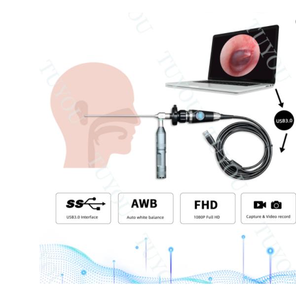 FHD Laptop Computer Camera System Portable Endoscope Camera Use for ENT Surgery